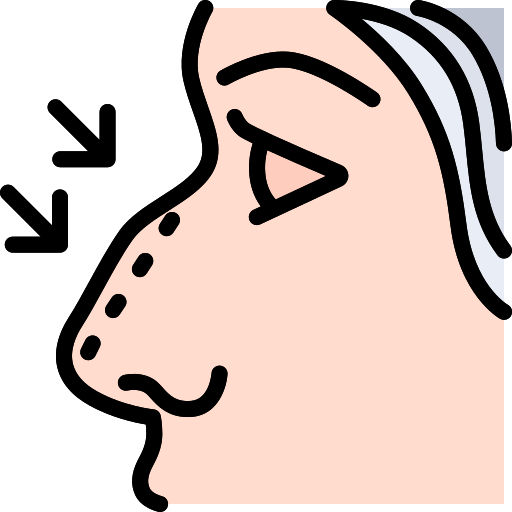 Revision Rhinoplasty