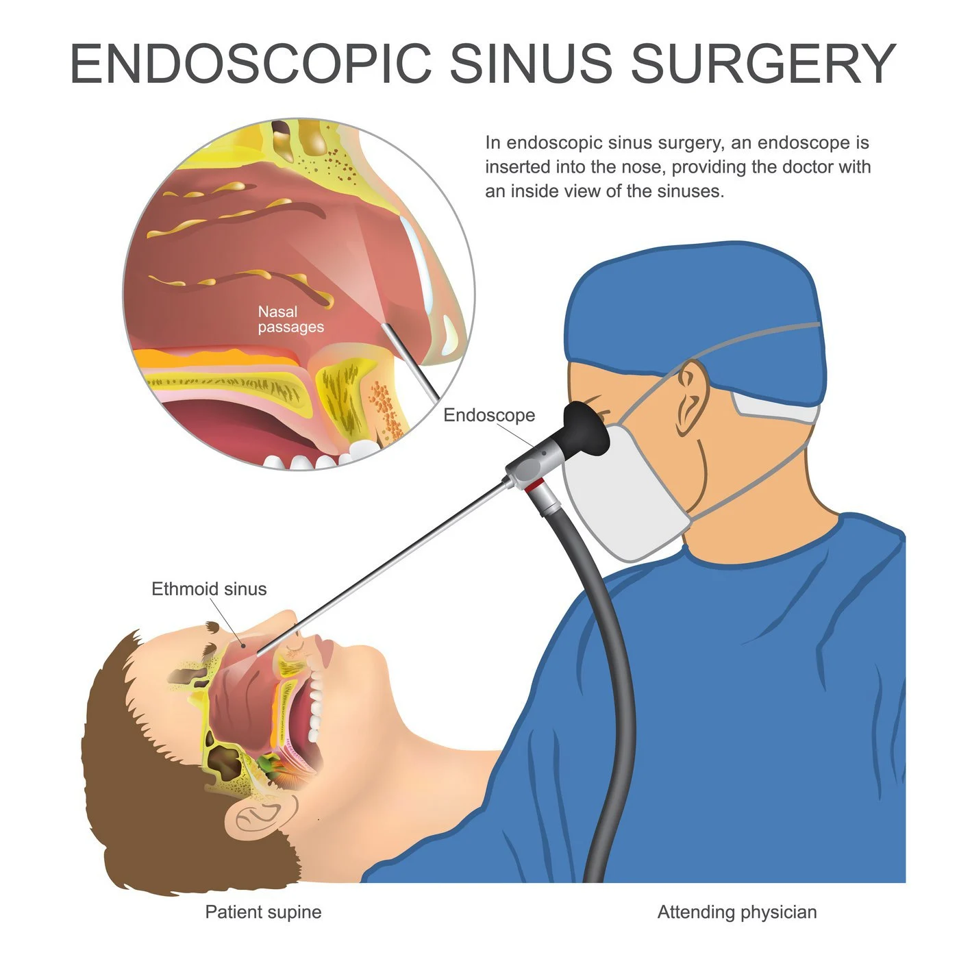 ENT surgery