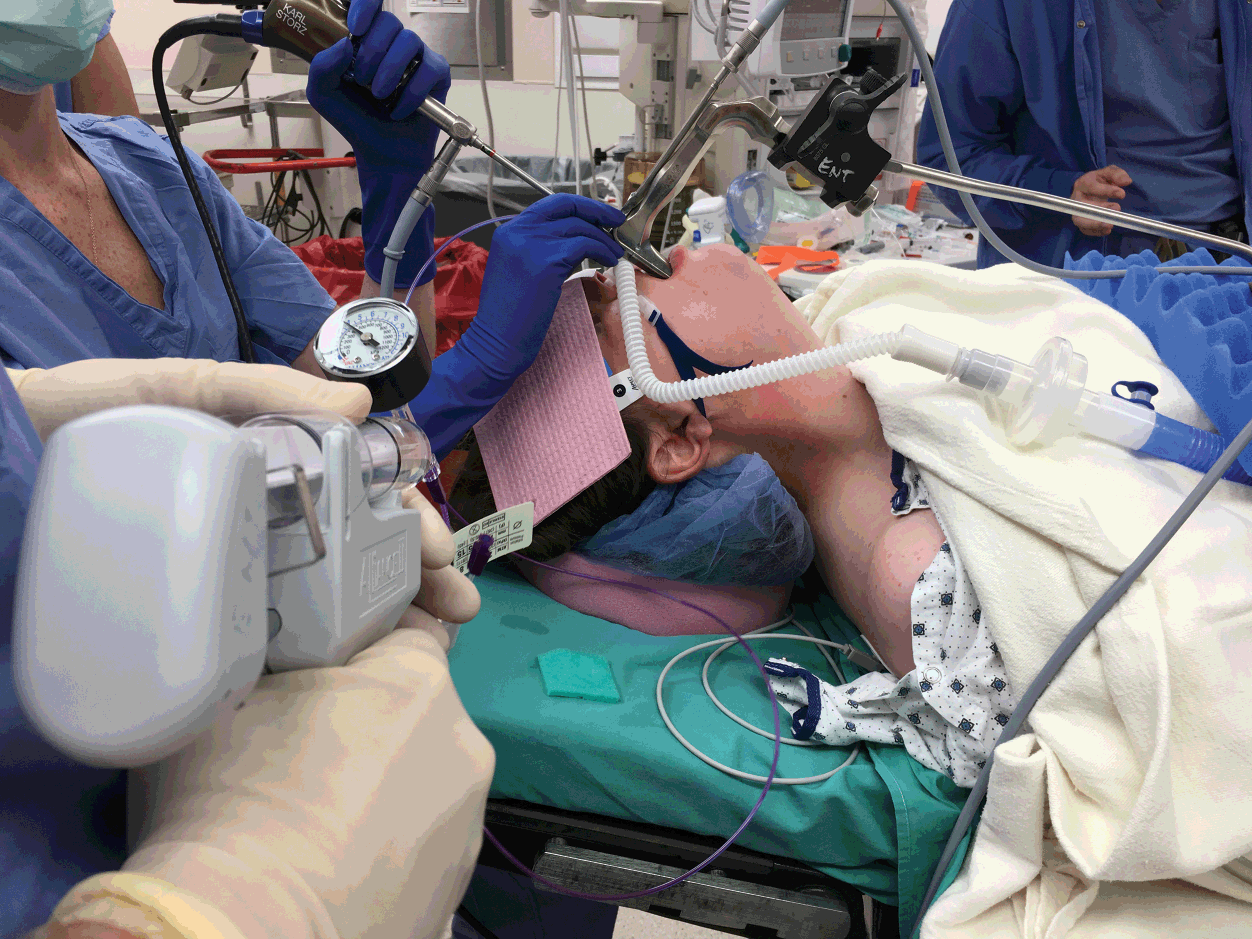 Top 10 Life-Changing Benefits of ENT Surgery