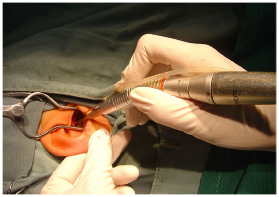 Dr. Andre Azar: The Best Otologic Surgeon for Advanced Ear Care 2025