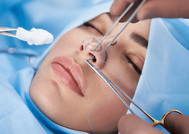 Ultrasonic Rhinoplasty